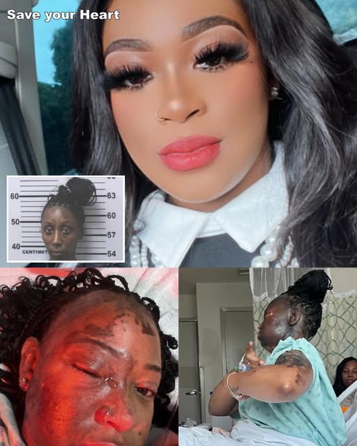 Jasmine Clausell (27) Obituary Caustic Attack: HORRIFIC BETRAYAL: Jasmine Clausell, 27, Suffers Severe Chemical Burns, Partial Blindness After Being Attacked By Homeless Friend She Sheltered