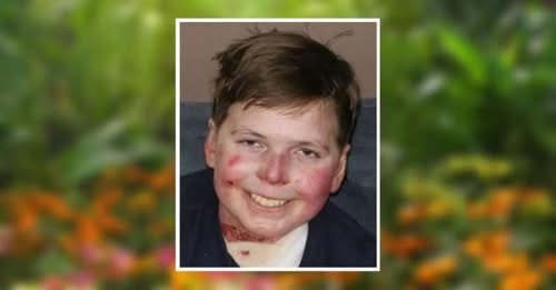 John Hudson Dilgen Staten Island, NY Obituary – John Hudson Dilgen Peaceful Passing – John Hudson Dilgen: The “Strongest Man in the World” and Global Face of Butterfly Skin Disease Dies at 22